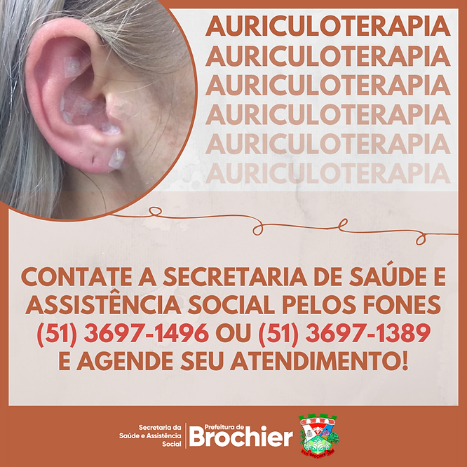 secretaria-de-saude-anuncia-retorno-das-sessoes-de-auriculoterapia